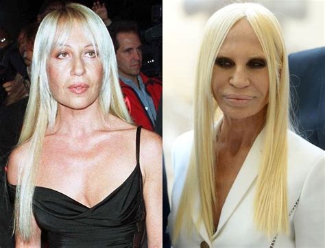 donatella versace fille|Donatella Versace before and after.